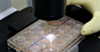 Copertina di Leucodistrofia metacromatica, con la terapia genica alcuni bambini “hanno mantenuto la capacità di camminare”
