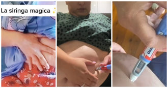 Copertina di “Ozempic Face”, non solo il corpo con strati di pelle flaccida e cascante. Chi lo usa corre dal chirurgo anche per salvare la faccia. La dottoressa: “Conseguenze devastanti”